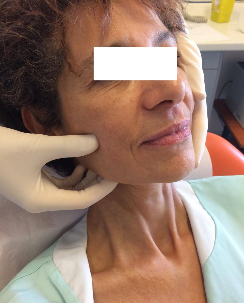 Examen exobuccal Dermatologie buccale — free download