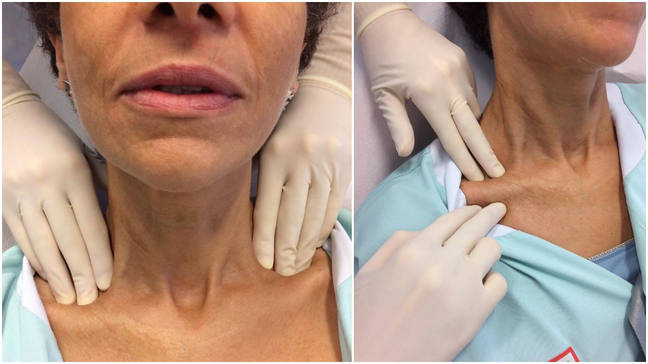 Examen exobuccal Dermatologie buccale
