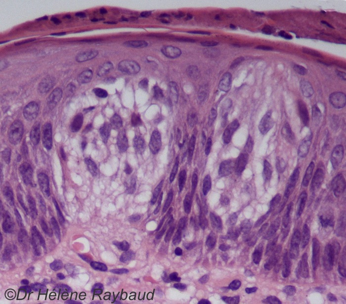 Langue Dermatologie buccale Langue Dermatologie buccale