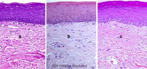 Histologie De La Muqueuse Buccale – Dermatologie Buccale