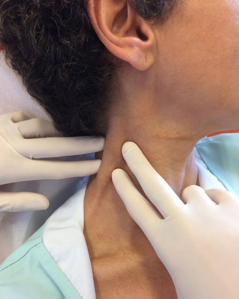 Examen exobuccal Dermatologie buccale